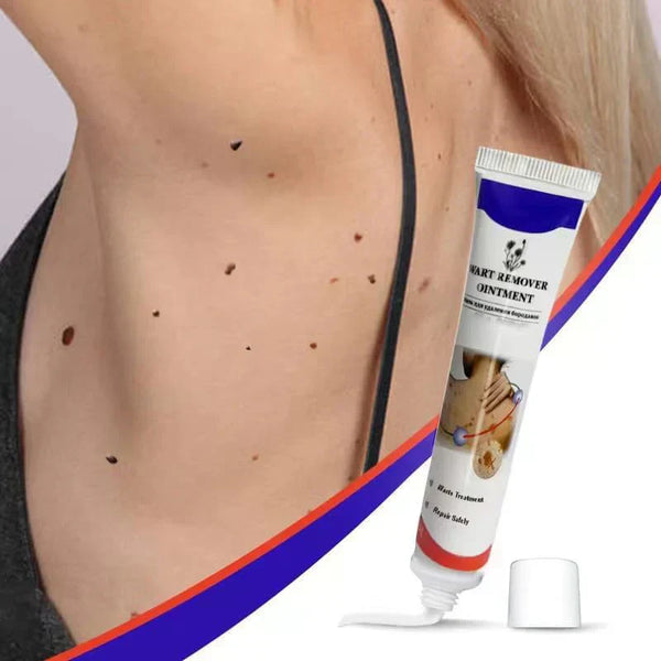 Warts Remover